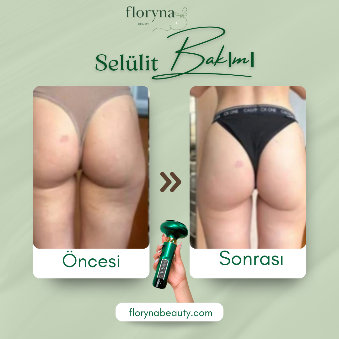 Floryna